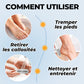 🔥Vente Flash - 50% DE RÉDUCTION🔥Éliminateur de Callosités Électrique pour les Pieds⚡