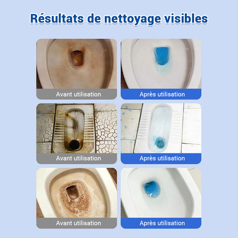 ✨Comprimés effervescents de nettoyage des toilettes - décontamination, tartre urinaire, alcali urinaire et élimination des odeurs