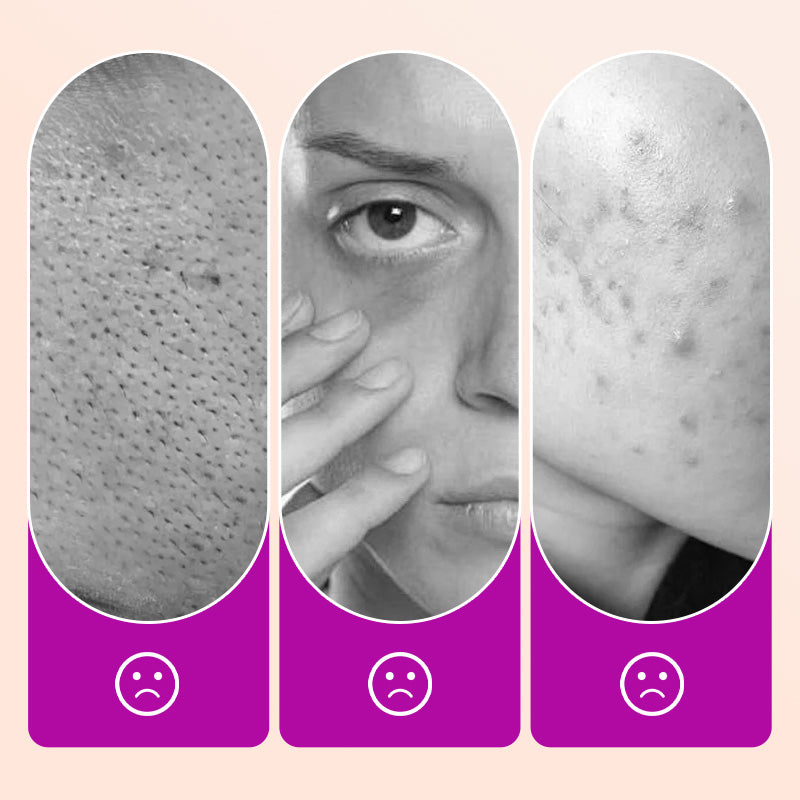✨Correcteur de texture crème glacée sans défaut🌟