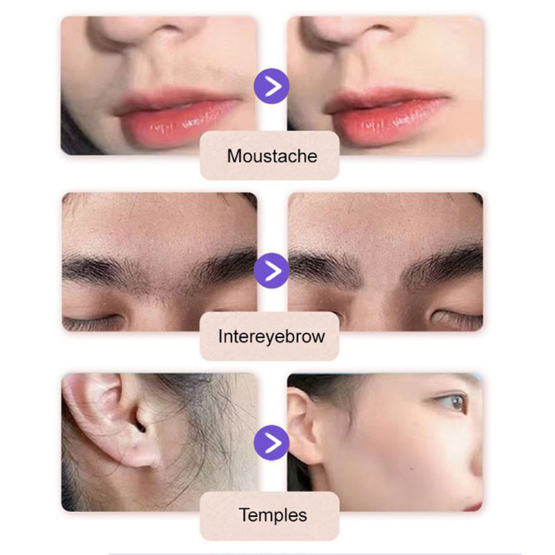 Crème Dépilatoire Douce et Indolore pour le Visage - Formule Hydratante, Testée Dermatologiquement