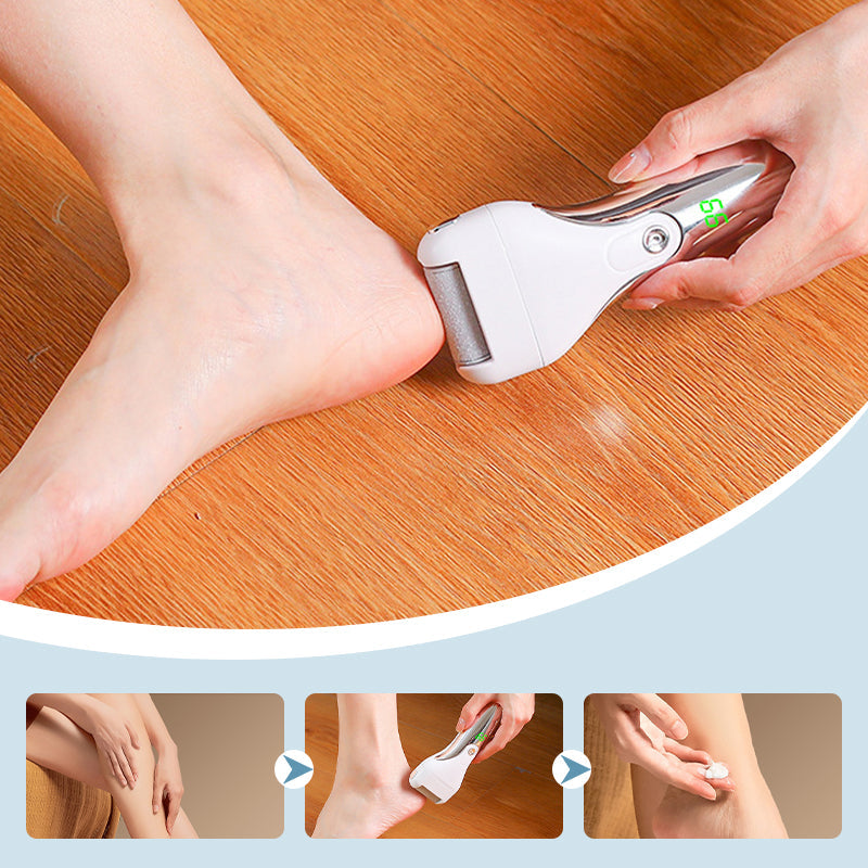 Kit de Lime à Pieds Électrique Anti-Callosités