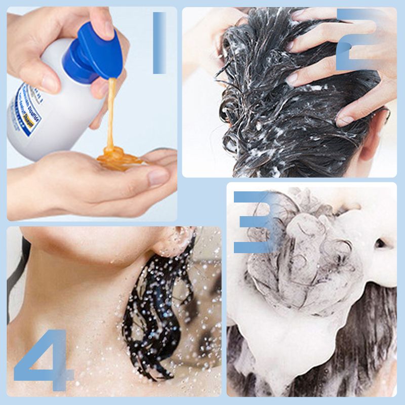 🏆Shampoing antipelliculaire au bisulfure de sélénium🌿🛡️