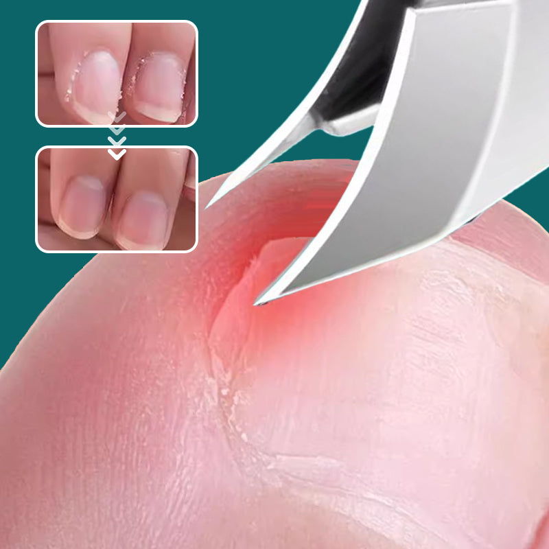 ⏰Set de 3 coupe-ongles biseautés anti-éclaboussures – Acier inoxydable, boîtier portable & lime en verre inclus🧼💅