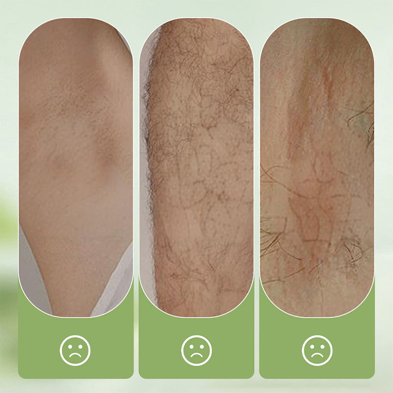💐50% DE RÉDUCTION ! Crème dépilatoire douce – Sans irritation, peau lisse ✨🌸【Plus de 50 000 vendus】