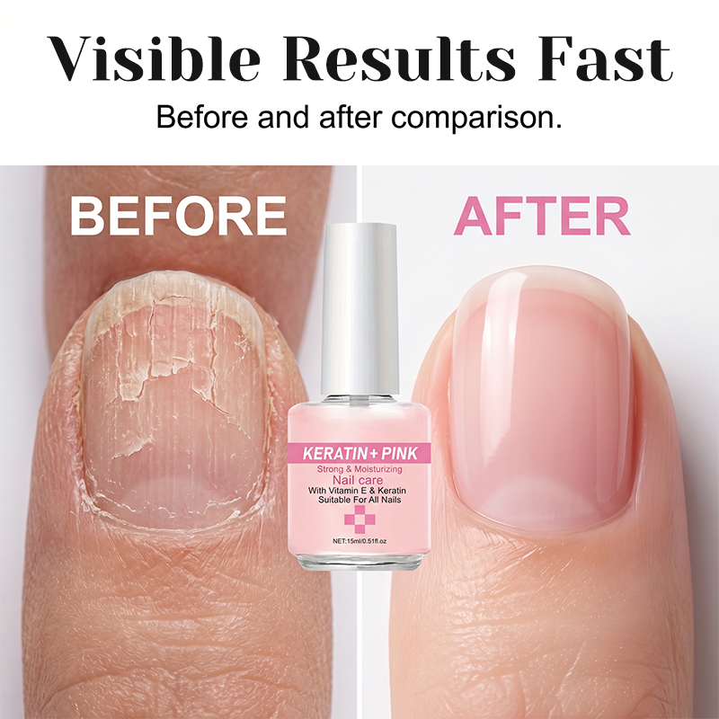 💅 Soldes 2026 — Plus de 19 000 vendus!✨1 Acheté = 1 Offert✨Soin Fortifiant & Hydratant pour Ongles à la Kératine