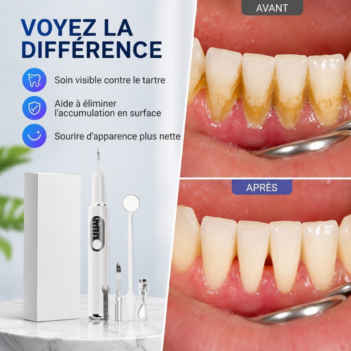 Set de nettoyeur de dents à ultrasons portable et de détartreur dentaire
